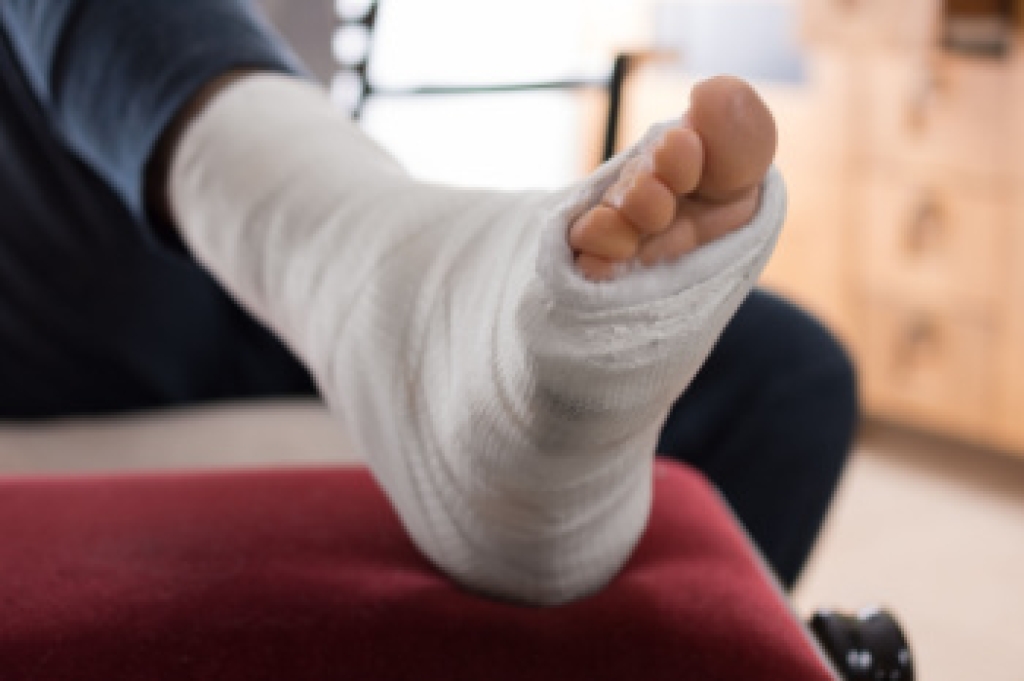 Signs You Should See a Podiatrist for a Broken Foot
