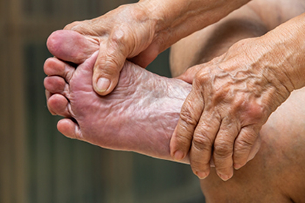 Causes of Heel and Back-of-Foot Pain in Older Adults