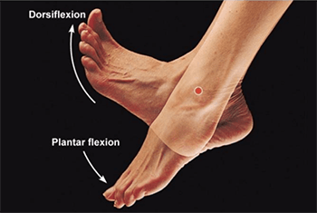 heel pain