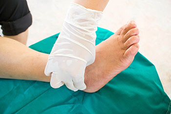 Diabetic Ulcers Treatment in the Los Angeles County, CA: Los Angeles, Beverly Hills, Culver City, Santa Monica, Marina Del Rey, Inglewood, Thousand Oaks, Burbank, Glendale, Pasadena, Malibu areas