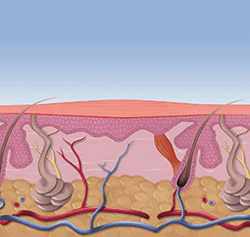 swift treatment Los Angeles County, CA: Los Angeles, Beverly Hills, Culver City, Santa Monica, Marina Del Rey, Inglewood, Thousand Oaks, Burbank, Glendale, Pasadena, Malibu