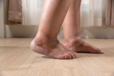 What Swollen Feet and Ankles May Reveal About Your Health